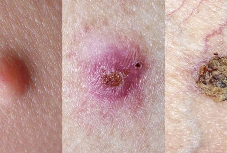 1732113835.135806_930431_image