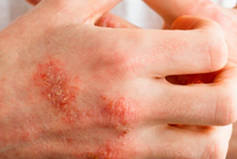 1732113846.85688_948643_image