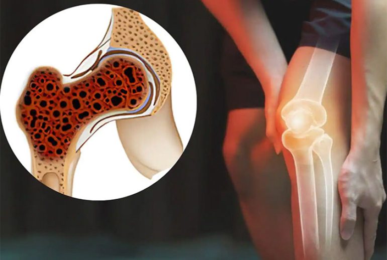 1732113858.347807_267987_image