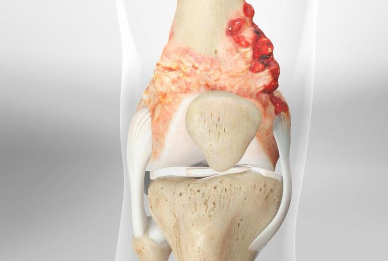 1732113869.338032_476817_image