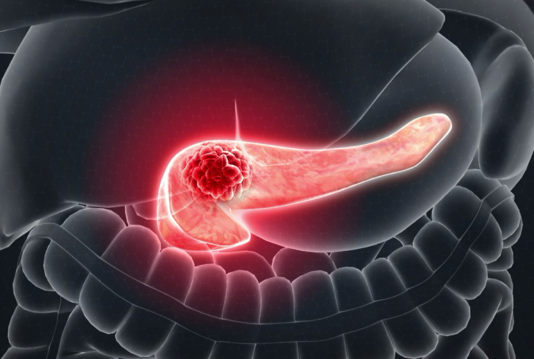 1732113893.207941_523625_image